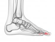 Huesos de falange distal en rayos X ilustración computarizada del pie humano . - foto de stock