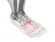 Метатарсальные кости в рентгеновской компьютерной иллюстрации человеческой стопы . — стоковое фото