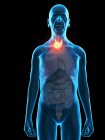 Ilustração digital da anatomia do homem sênior mostrando o tumor da glândula tireoide
. — Fotografia de Stock