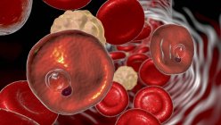 Plasmodium vivax Protozoen im Blutgefäß, digitale Illustration. — Stockfoto