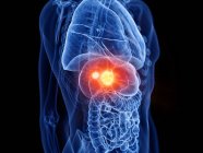 Прозоре чоловіче тіло з раком печінки, цифрова ілюстрація . — стокове фото