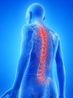 Ilustración anatómica digital de la espalda dolorosa del hombre mayor . - foto de stock