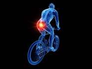 Cyclist skeleton with pain in coccyx, computer illustration — Stock Photo