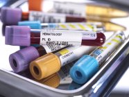 Close-up de sangue humano e várias amostras de hematologia em tubos de ensaio durante a triagem em laboratório médico . — Fotografia de Stock