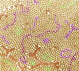 Borde del cepillo intestinal en el intestino delgado que muestra numerosas microvellosidades, micrografía electrónica de transmisión coloreada . - foto de stock