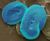Colored scanning electron micrograph of coccoliths calcium carbonate plates from coccolithophore algal organisms. — Stock Photo