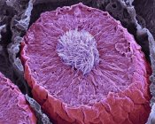 Farbige Rasterelektronenmikroskopie eines durchtrennten Samenröhrchens, Ort der Spermienproduktion im menschlichen Hoden. — Stockfoto