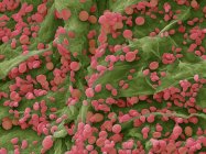 Micrografia eletrônica de varredura colorida da variedade de espécies de leveduras que crescem no túnel larval da mariposa Cydia pomonella em maçã madura . — Fotografia de Stock