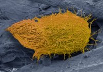 Micrografia eletrônica de varredura colorida do protozoário ciliado predatório Loxophyllum . — Fotografia de Stock