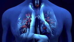 Концептуальна ілюстрація частинок коронавірусу в легенях людини . — стокове фото