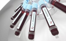 Flacons de sang dans des tests de centrifugation de laboratoire pour l'infection par le coronavirus, illustration numérique conceptuelle
. — Photo de stock