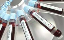 Flaconcini di sangue nei test di centrifuga di laboratorio per l'infezione coronavirica, illustrazione digitale concettuale . — Foto stock