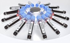 Centrifuger des échantillons de sang dans des éprouvettes à codes à barres, illustration numérique . — Photo de stock