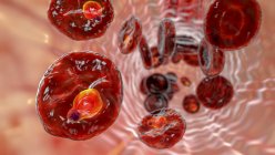 Овальный пузырь внутри красных кровяных клеток на стадии кольцевой формы трофозоита, компьютерная иллюстрация — стоковое фото