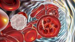 Blood cells and Plasmodium sp. parasites (at schizont stage) causing malaria, computer illustration. — Stock Photo