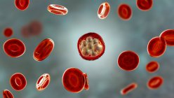 Кров'яні клітини та сполуки плазмодію. паразити (на стадії шизону) викликають малярію, комп'ютерна ілюстрація . — стокове фото