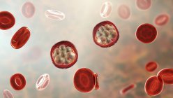 Blutkörperchen und Plasmodium sp. Parasiten (im Schizonstadium), die Malaria verursachen, Computerillustration. — Stockfoto