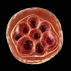 Rote Blutkörperchen infiziert mit Plasmodium sp. Parasiten (im Schizonstadium), die Malaria verursachen, Computerillustration. — Stockfoto