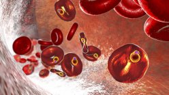 Plasmodium malariae protozoan inside red blood cells in the ring-form trophozoite stage, computer illustration — Stock Photo