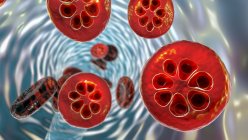 Protozoos Plasmodium malariae dentro de los glóbulos rojos en la etapa de esquizontes, ilustración por ordenador - foto de stock