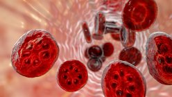 Protozoos Plasmodium malariae dentro de los glóbulos rojos en la etapa de esquizontes, ilustración por ordenador - foto de stock