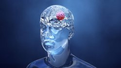 Рак мозку, концептуальна комп'ютерна ілюстрація — стокове фото