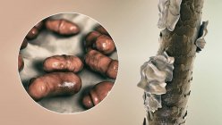 Комп'ютерна ілюстрація, що показує волосся людини з лупою та крупним планом мікроскопічних грибів Маласезія хутро, пов'язане з себорейним дерматитом та утворенням лупи — стокове фото