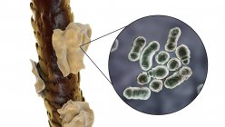 Компьютерная иллюстрация, показывающая человеческие волосы с перхоти и крупным планом микроскопических грибов Malassezia furfur, связанных с себорейным дерматитом и перхоти образования — стоковое фото