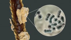 Компьютерная иллюстрация, показывающая человеческие волосы с перхоти и крупным планом микроскопических грибов Malassezia furfur, связанных с себорейным дерматитом и перхоти образования — стоковое фото