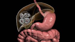 Doença hidática no fígado causada por larvas de ténia parasitária Echinococcus multilocularis, ilustração computadorizada — Fotografia de Stock