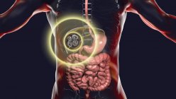 Doença hidática no fígado causada por larvas de ténia parasitária Echinococcus multilocularis, ilustração computadorizada — Fotografia de Stock