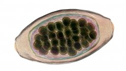 Œufs de vers parasites Trichuris Xoura, illustration par ordinateur — Photo de stock