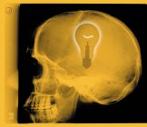 Human skull with light bulb, coloured X-ray. — Stock Photo