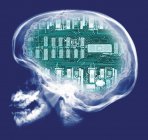Crâne humain et carte de circuit informatique, rayons X colorés. — Photo de stock