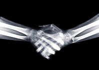Apretón de manos, rayos X, exploración radiológica - foto de stock