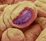 Darmschleimhaut. Farbige Rasterelektronenmikroskopie (REM) eines gefriergetrockneten Dünndarms. Die Oberfläche besteht aus tiefen Falten, die Zotten genannt werden. Die Darmoberfläche (gelb) ist der Nahrung ausgesetzt — Stockfoto