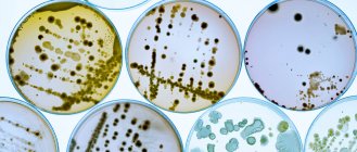 Бактеріальні колонії на агарах — стокове фото