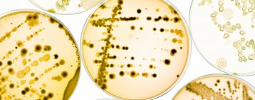 Colônias bacterianas em placas de ágar — Fotografia de Stock