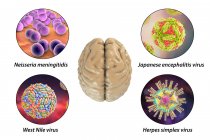 Инфекции мозга. Компьютерная иллюстрация микроорганизмов, вызывающих энцефалит и менингит — стоковое фото