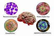 Infections cérébrales. Illustration informatique des micro-organismes responsables de l'encéphalite et de la méningite — Photo de stock