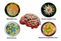 Brain infections. Computer illustration of microorganisms that cause encephalitis and meningitis — Stock Photo