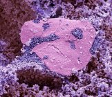 Bactérias dos pés. Micrografia eletrônica de varredura colorida (MEV) de bactérias cultivadas entre dedos do pé — Fotografia de Stock