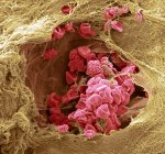 Кровеносные сосуды кожи. Цветной сканирующий электронный микрограф (СЭМ) кровеносного сосуда (артериола) в дерме кожи. В кровеносных сосудах красные кровяные тельца (эритроциты, красные), которые несут кислород вокруг тела — стоковое фото