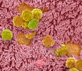Image composite de l'épithélium nasal et du pollen. Micrographie électronique à balayage coloré (SEM) de la surface de l'épithélium nasal avec inhalation dans le pollen. — Photo de stock