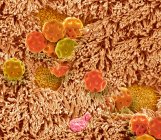 Imagen compuesta de epitelio nasal y polen. Micrografía electrónica de barrido coloreada (SEM) de la superficie del epitelio nasal con polen inhalado. - foto de stock