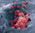 Vasos sanguíneos cutâneos. Micrografia eletrônica de varredura colorida (MEV) de um vaso sanguíneo (arteríola) na derme da pele. No vaso sanguíneo estão os glóbulos vermelhos (eritrócitos, vermelhos) que transportam oxigénio ao redor do corpo — Fotografia de Stock