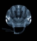 Bicycle helmet, X-ray, radiology scan — Stock Photo