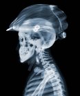 Jinete con casco de bicicleta, rayos X - foto de stock