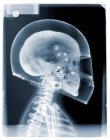 Motorista com capacete de condução, raio-X — Fotografia de Stock