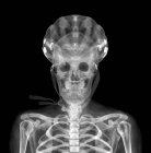 Cráneo y casco, rayos X. - foto de stock